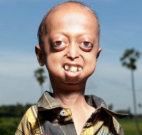 65qsq5@{r@hr4u)cfgi5[[v